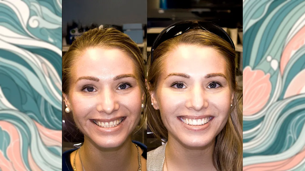 Cosmetic dentistry smile