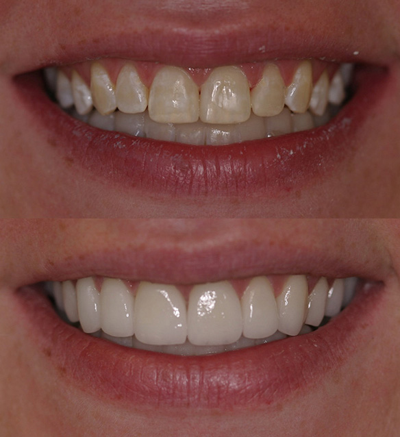 Cosmetic Dentistry